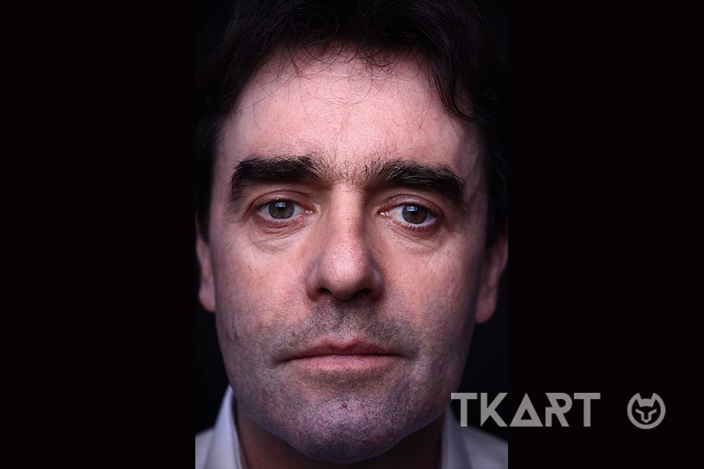 Testo Alternativo